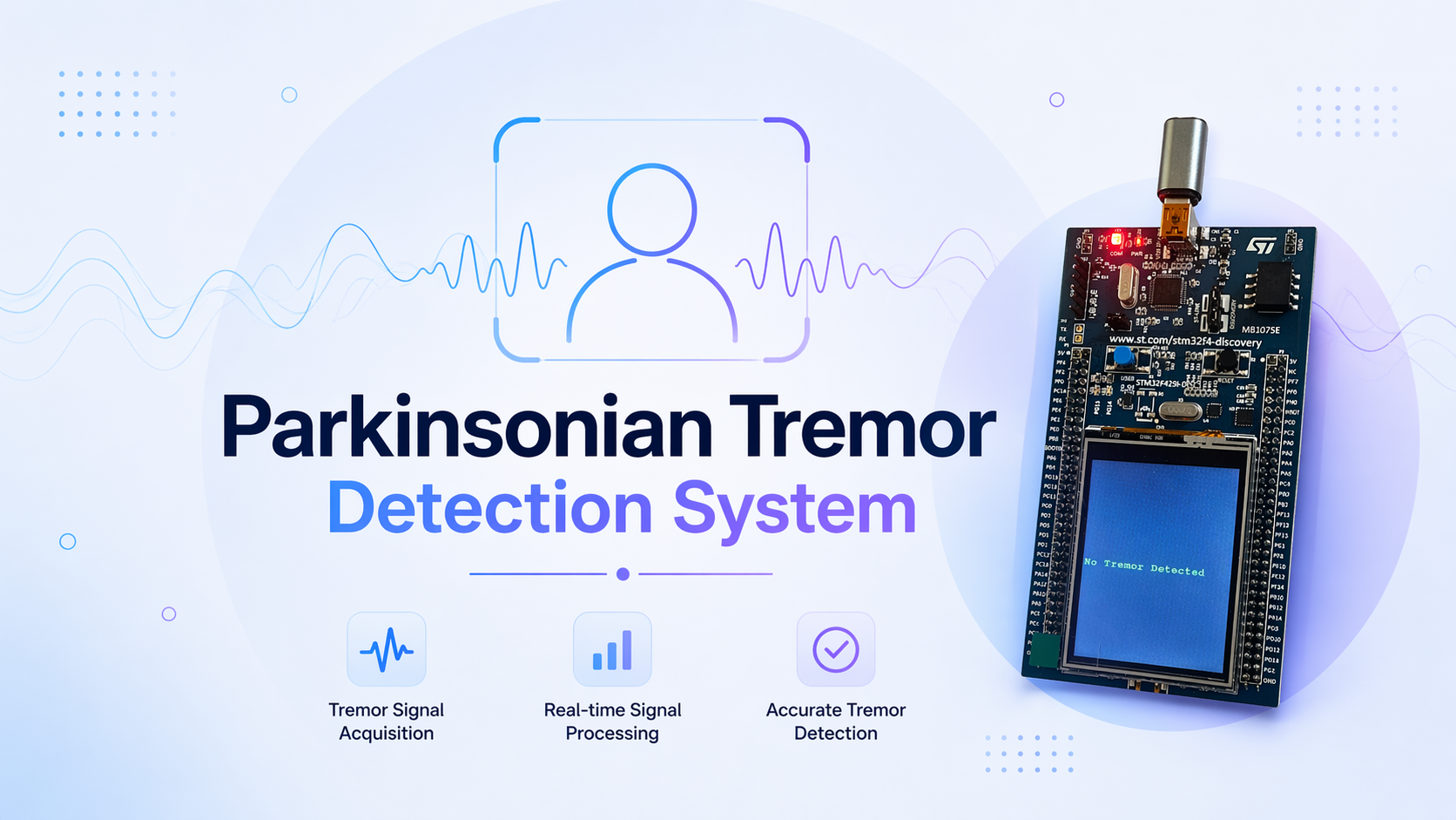 Parkinsonian tremor detection project image